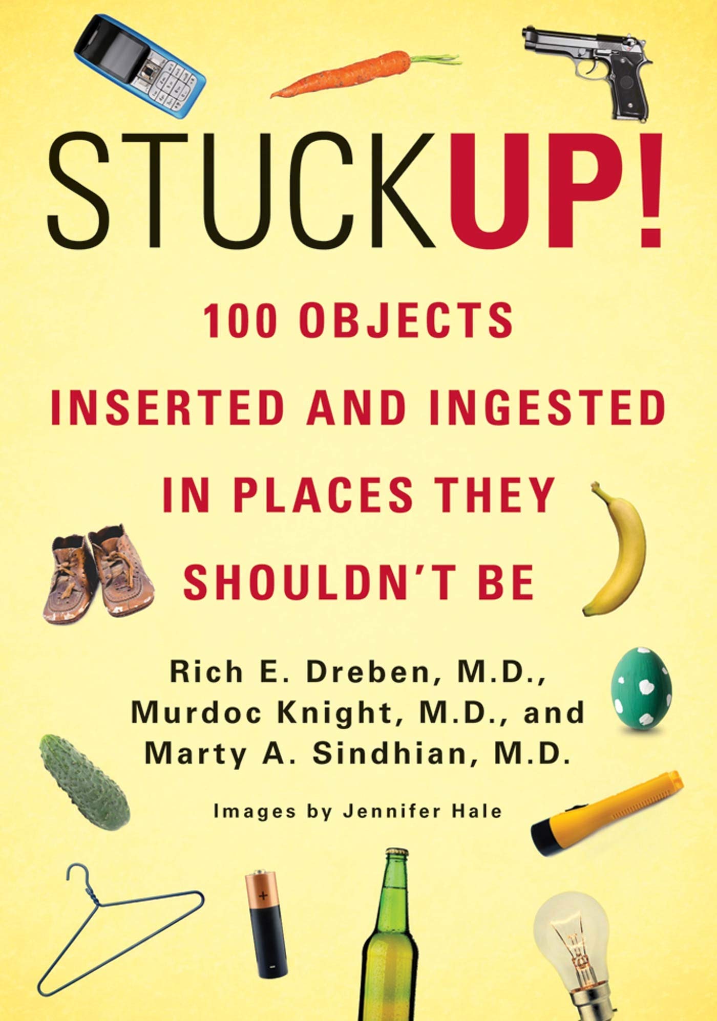 Stuck Up!: 100 Objects Inserted and Ingested in Places They Shouldnt Be