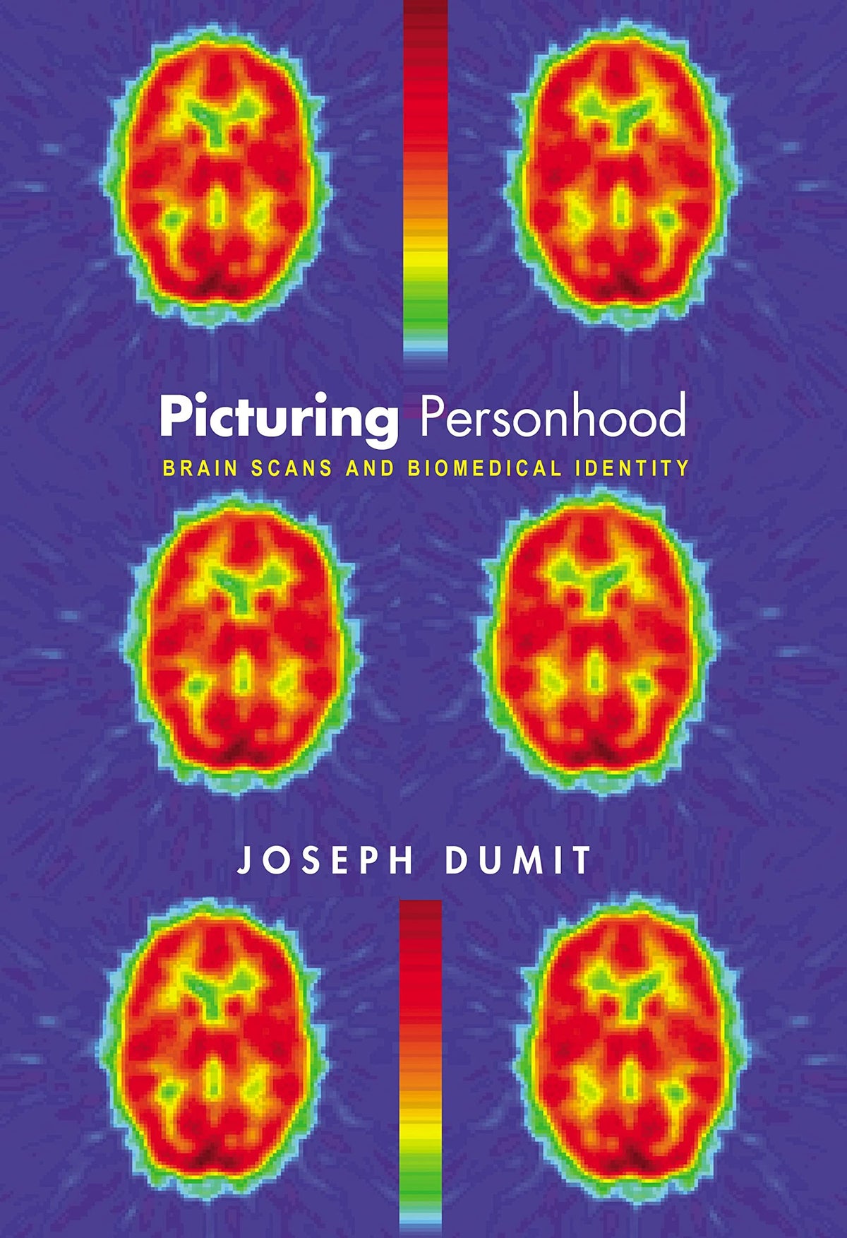 Picturing Personhood: Brain Scans and Biomedical Identity (In-Formation)