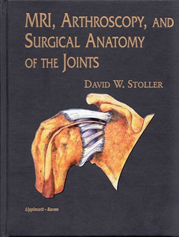 Mri, Arthroscopy, and Surgical Anatomy of the Joints
