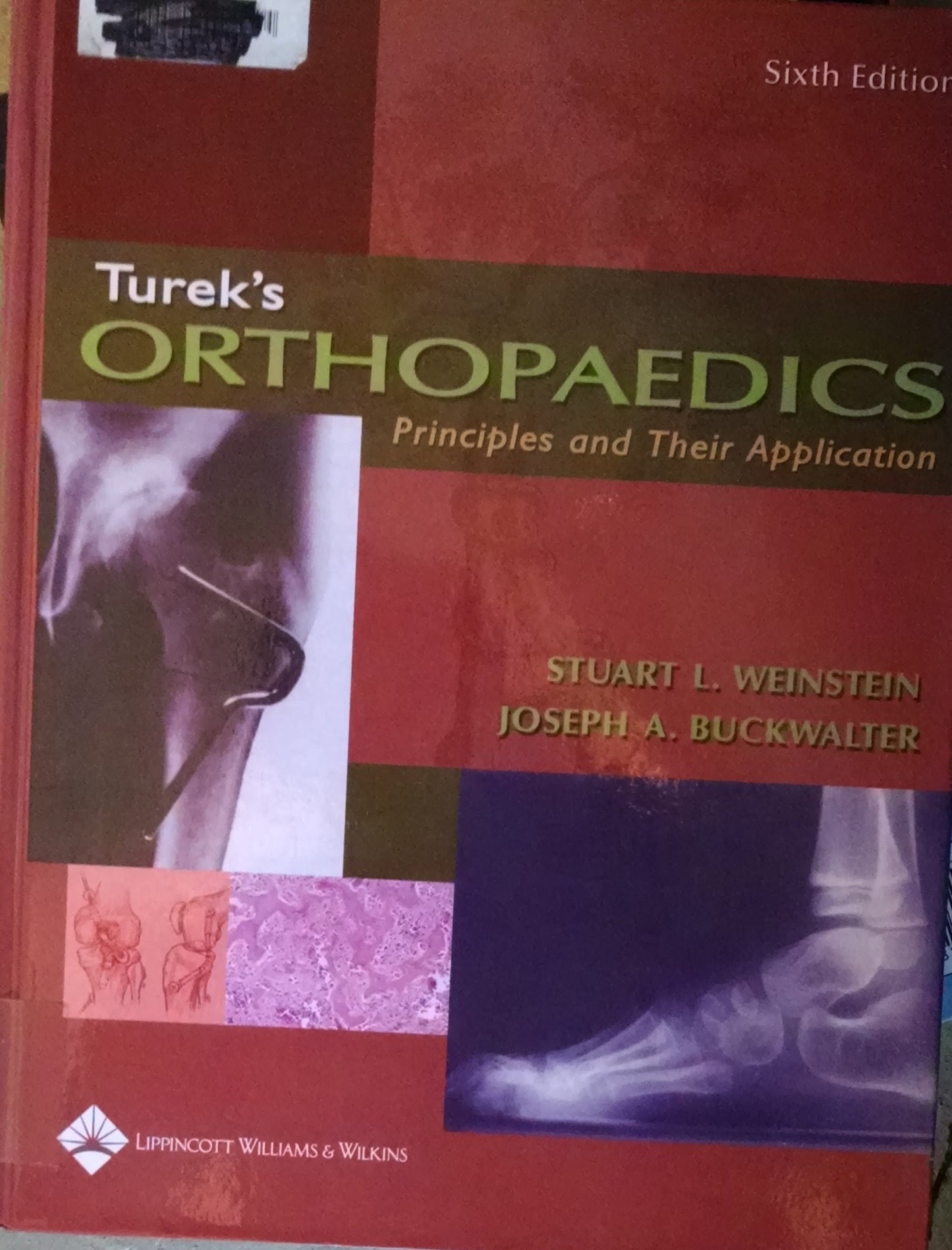 Turek's Orthopaedics: Principles And Their Application (ORTHOPAEDICS: PRINCIPLES & THEIR APPLICATION ( TUREK'S))