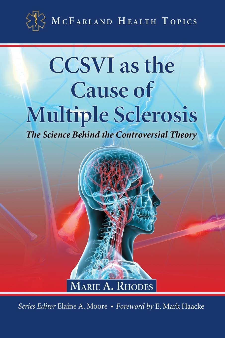 CCSVI as the Cause of Multiple Sclerosis: The Science Behind the Controversial Theory (McFarland Health Topics) - 4139