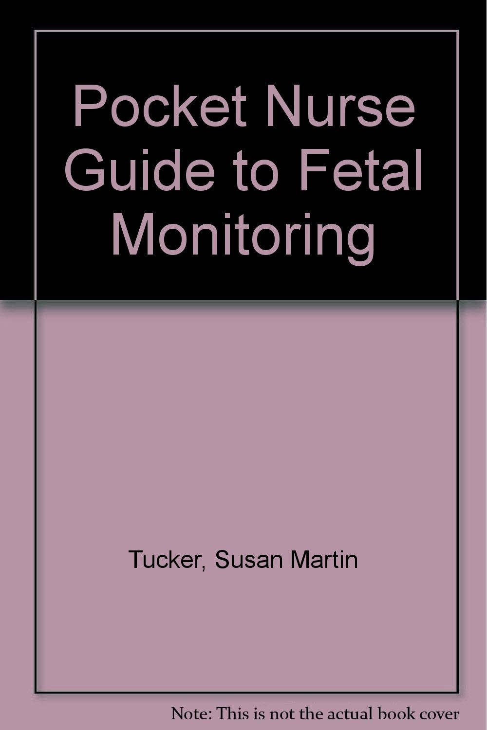 Pocket Nurse Guide to Fetal Monitoring
