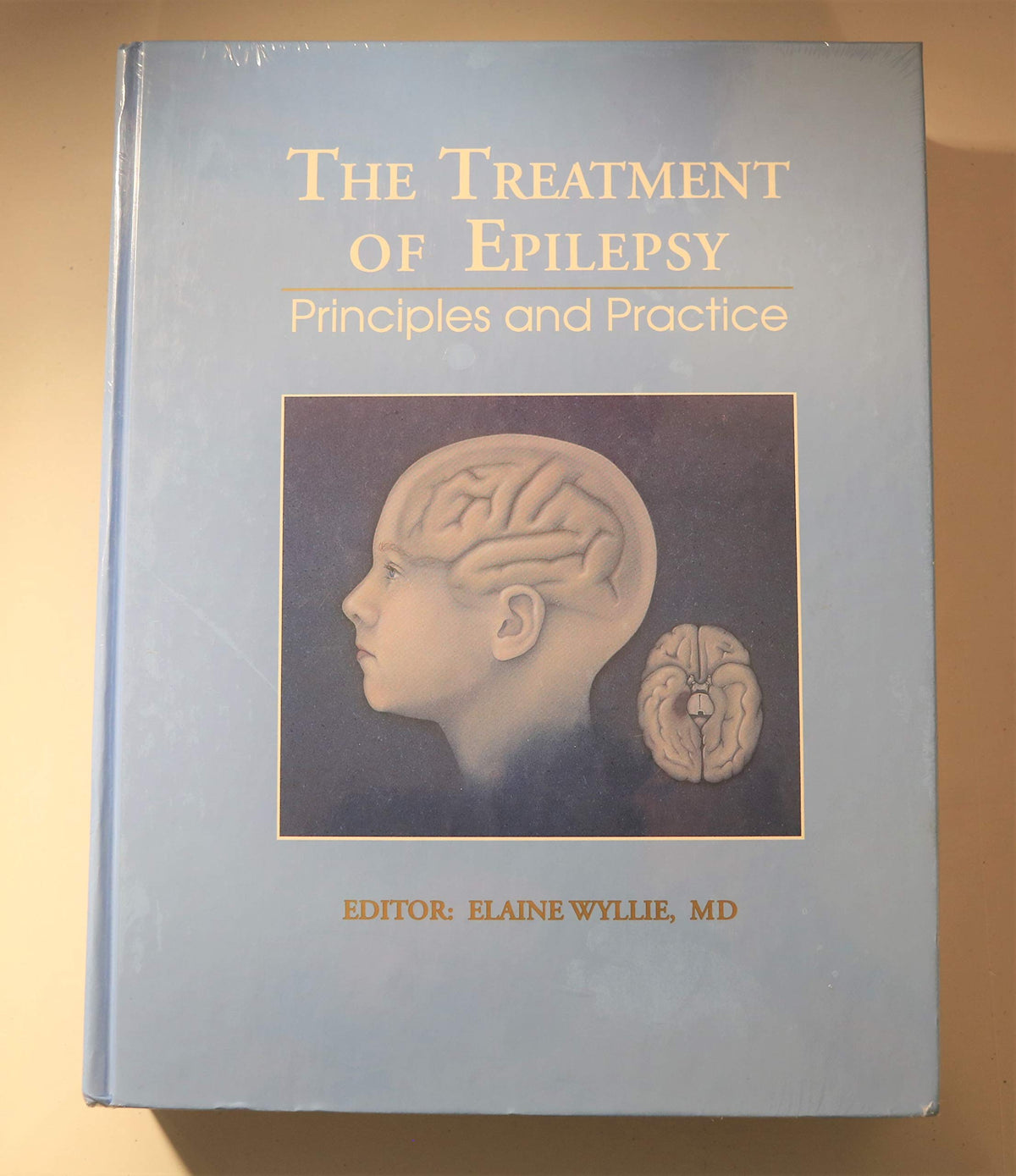 The Treatment of Epilepsy: Principles and Practice