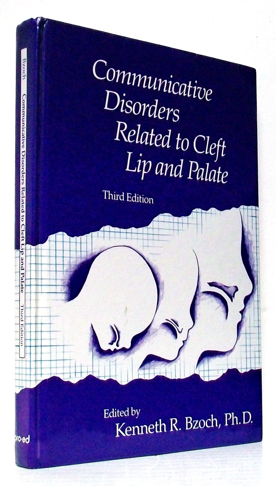 Communicative Disorders Related to Cleft Lip and Palate