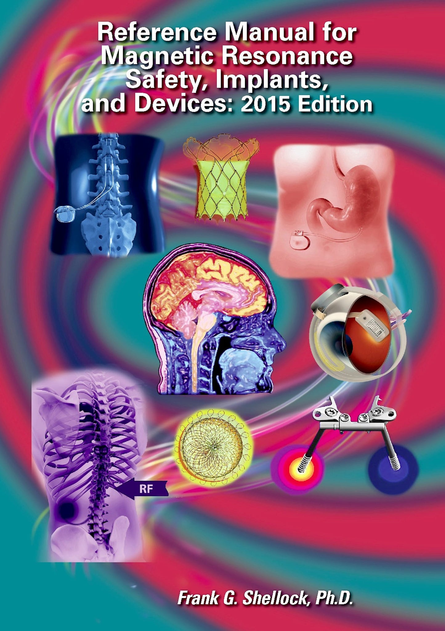 Reference Manual for Magnetic Resonance Safety, Implants and Devices 2015