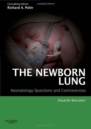The Newborn Lung: Neonatology Questions and Controversies: Expert Consult - Online and Print
