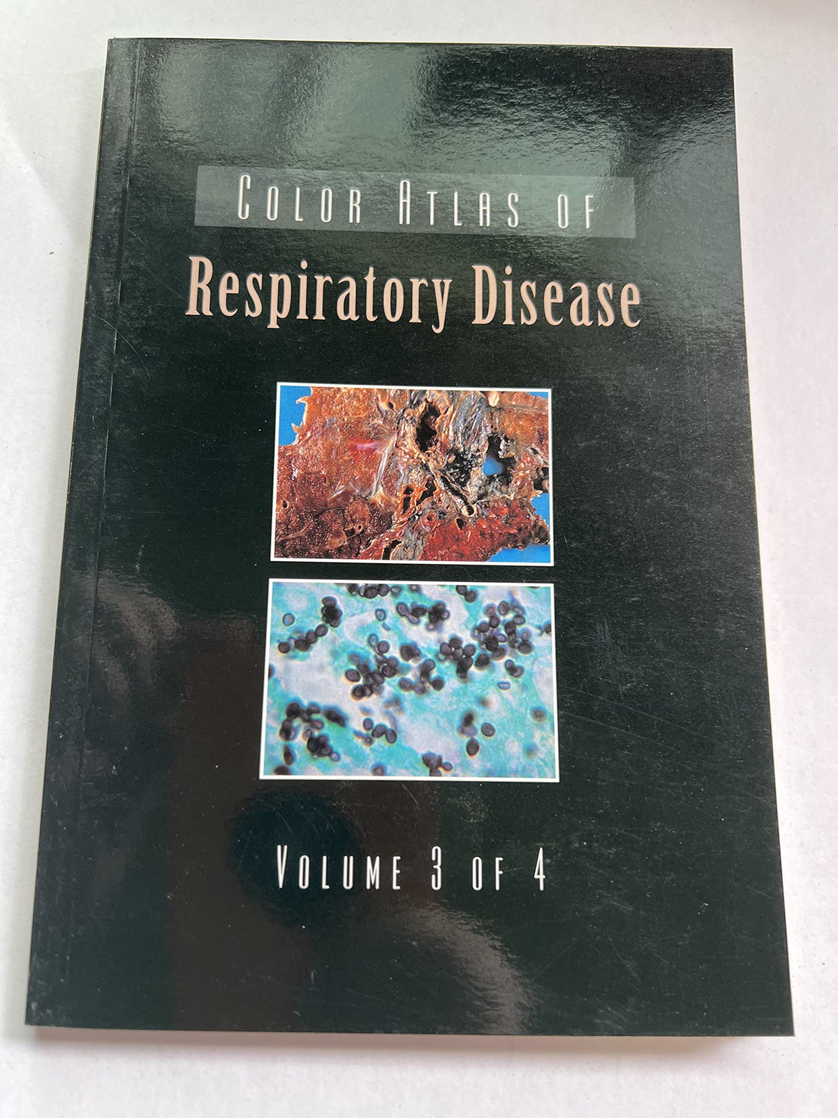 Color Atlas of Respiratory Disease, Volume 3
