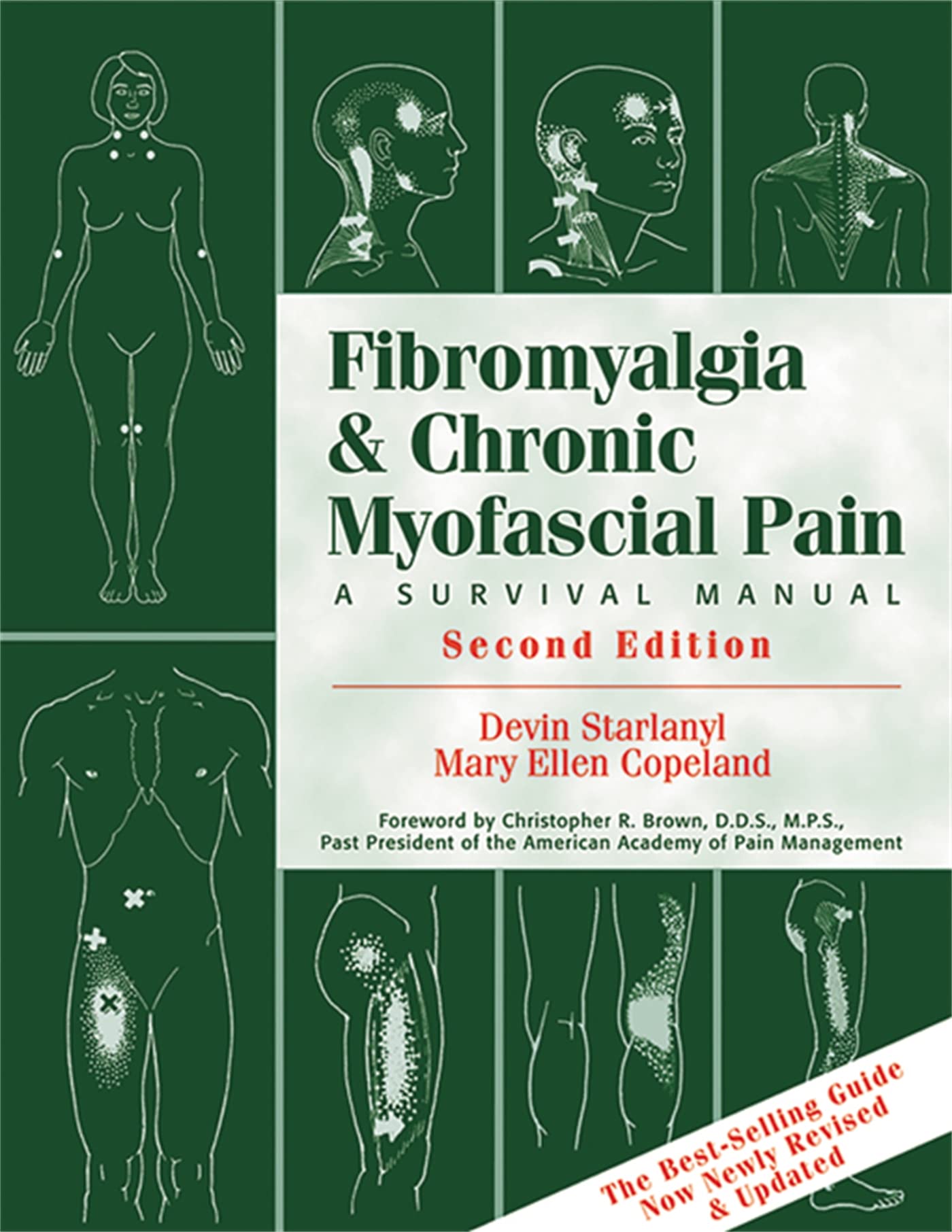 Fibromyalgia and Chronic Myofascial Pain: A Survival Manual (2nd Edition) - 6108
