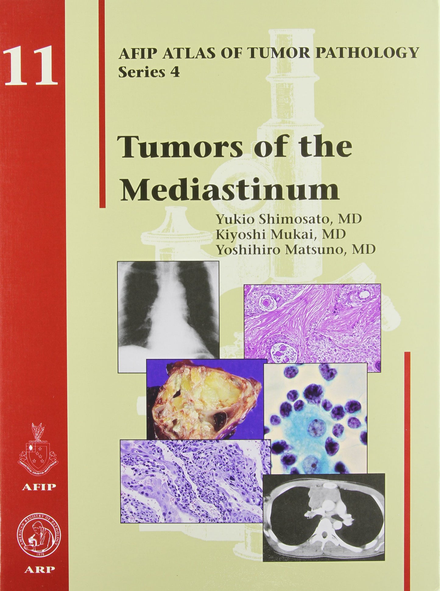TUMORS OF THE MEDIASTINUM (AFIP Atlas of Tumor Pathology, Series 4)