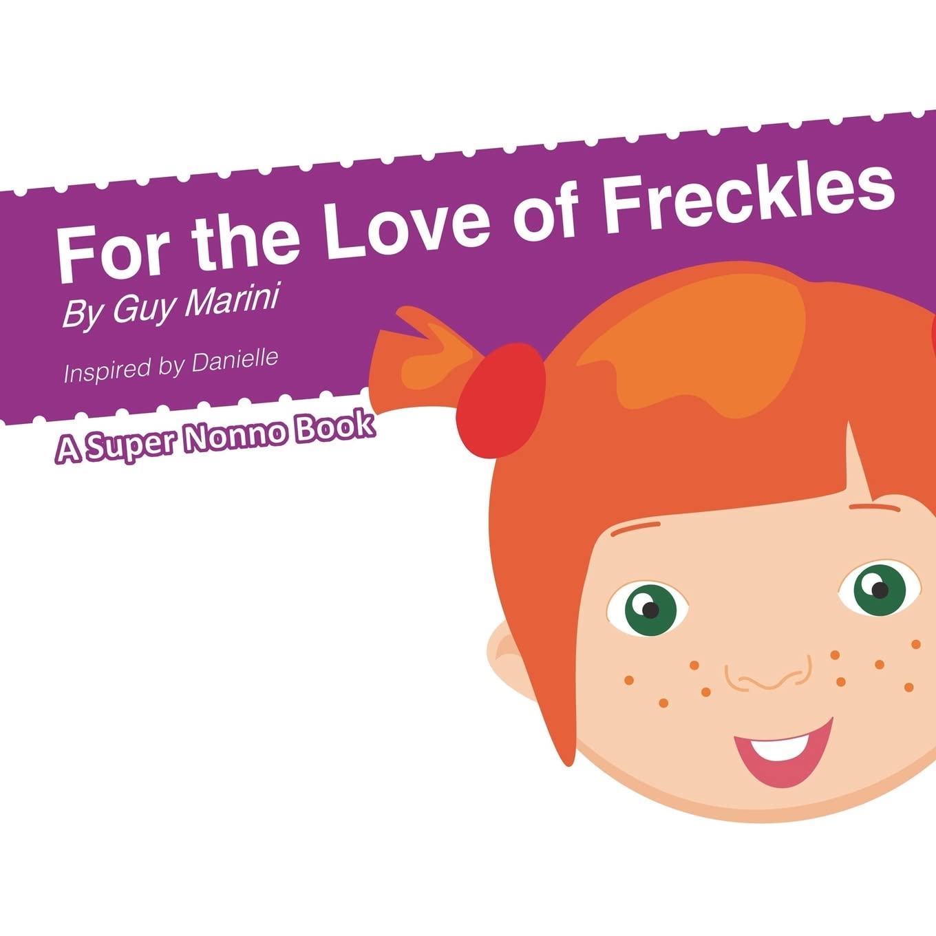 For the Love of Freckles - 5673