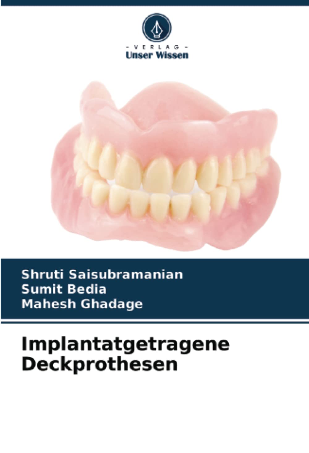 Implantatgetragene Deckprothesen (German Edition)