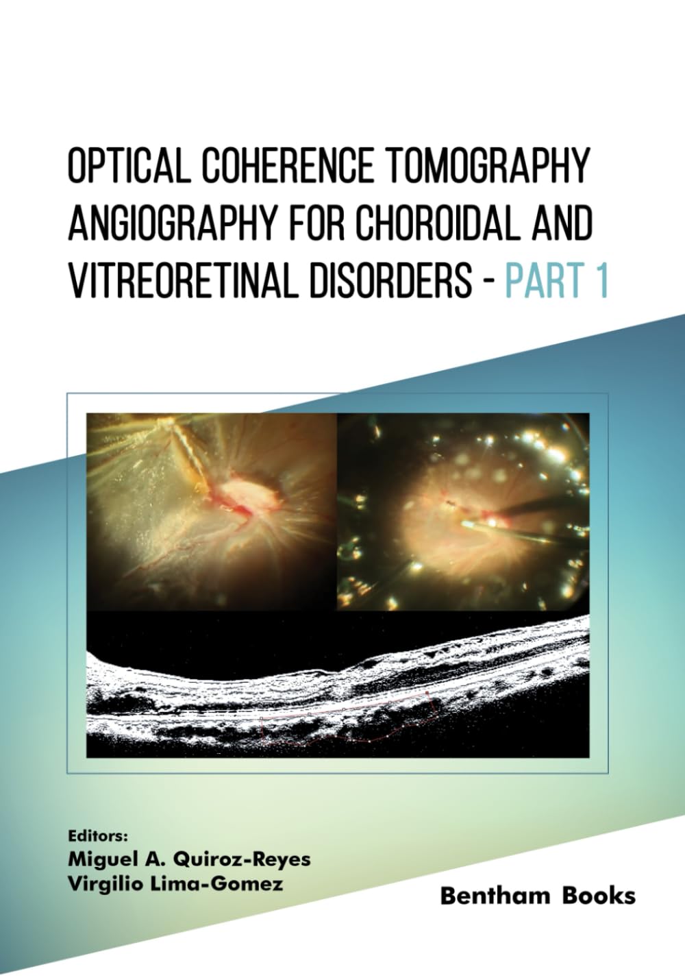 Optical Coherence Tomography Angiography for Choroidal and Vitreoretinal Disorders - Part 1