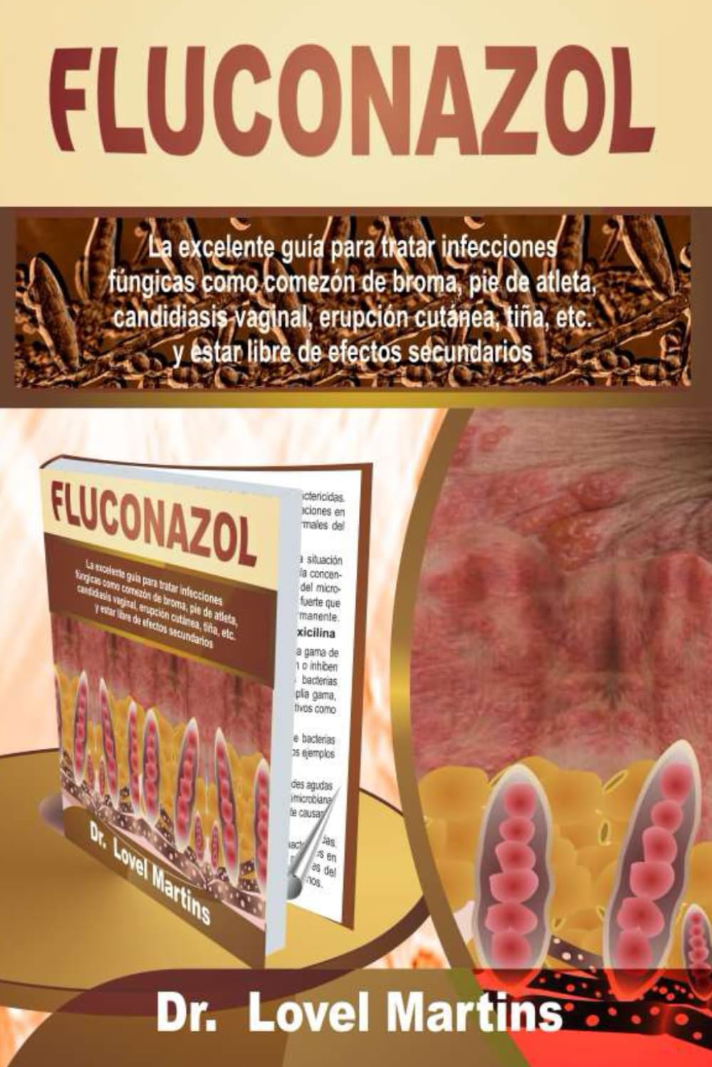 FLUCONAZOL: La excelente guía para tratar infecciones fúngicas como comezón de broma, pie de atleta, candidiasis vaginal, erupción cutánea, tiña, etc. ... de efectos secundarios (Spanish Edition) - 2180