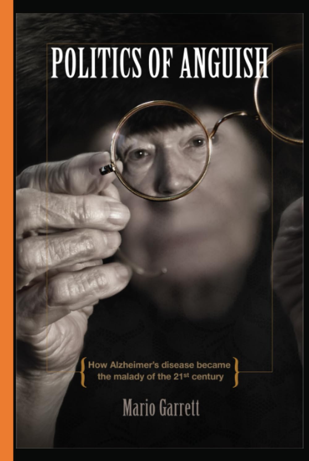 Politics of Anguish: How Alzheimer's disease became the malady of the 21st century