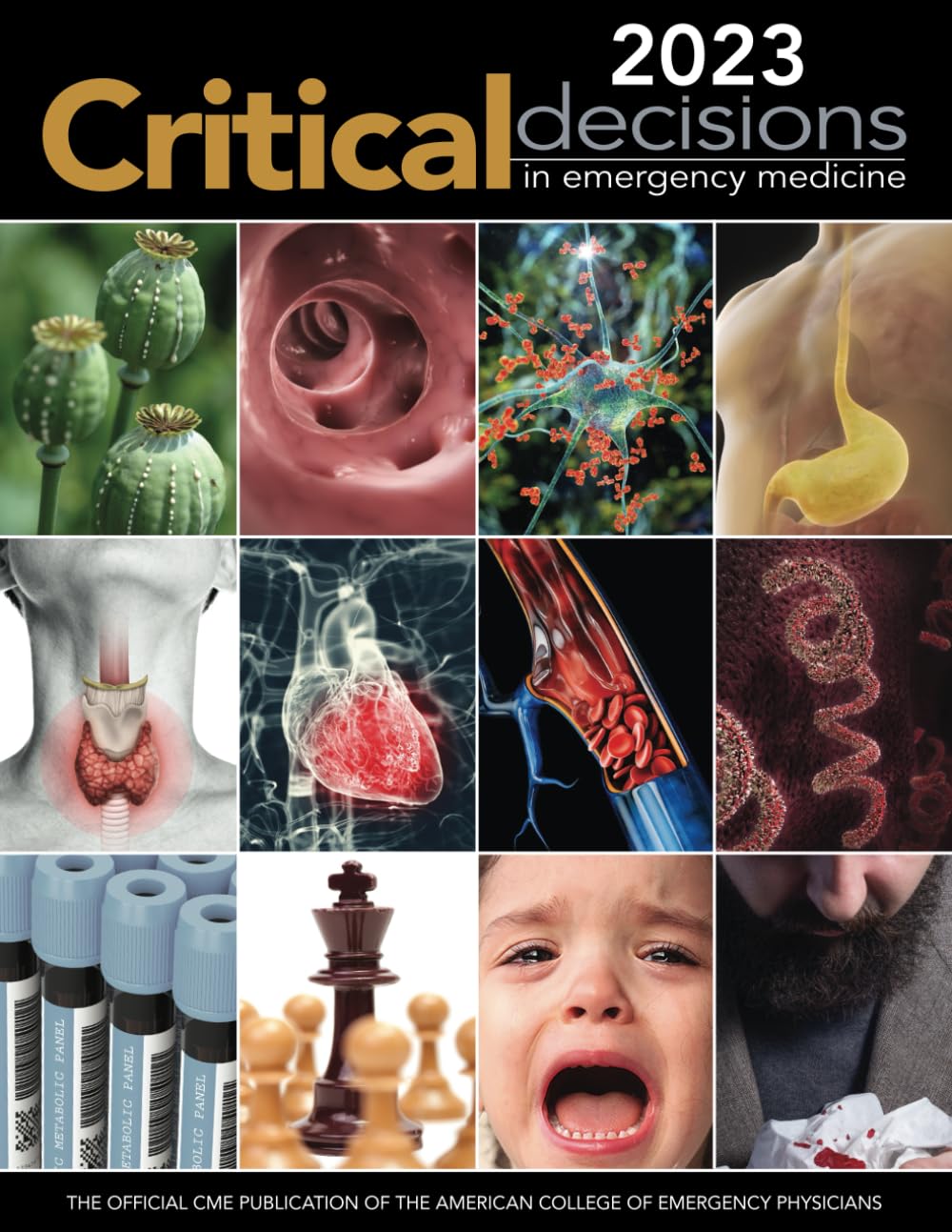 2023 Critical Decisions in Emergency Medicine: The Official CME Publication of the American College of Emergency Medicine (Critical Decisions in Emergency Medicine Annual Collection) - 8913