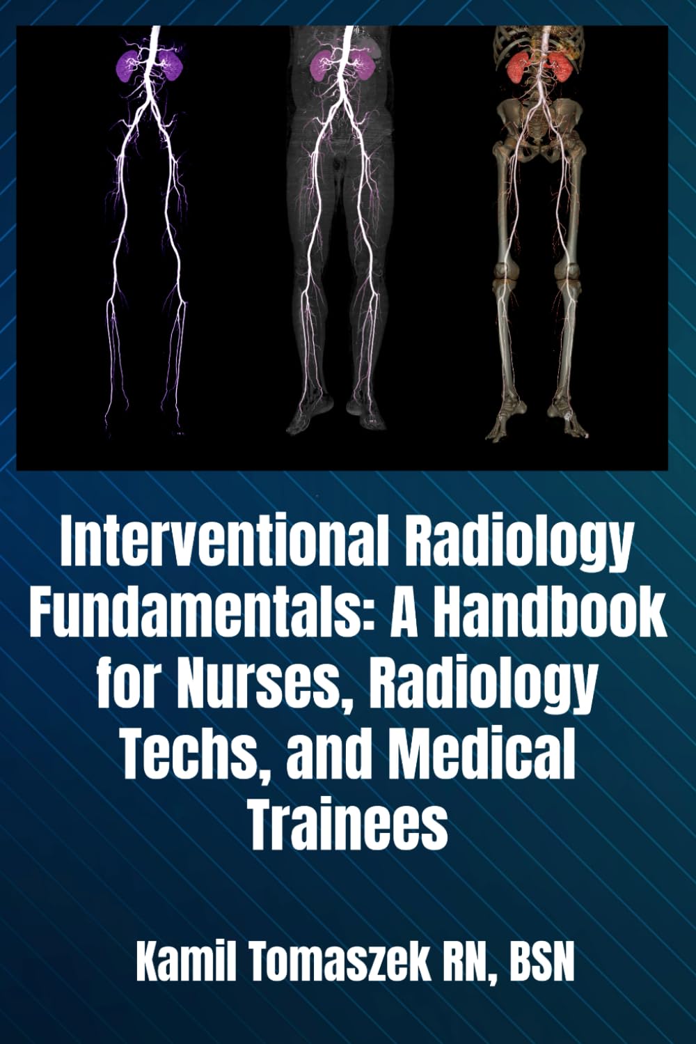 Interventional Radiology Fundamentals: A Handbook for Nurses, Radiology Techs, and Medical Trainees