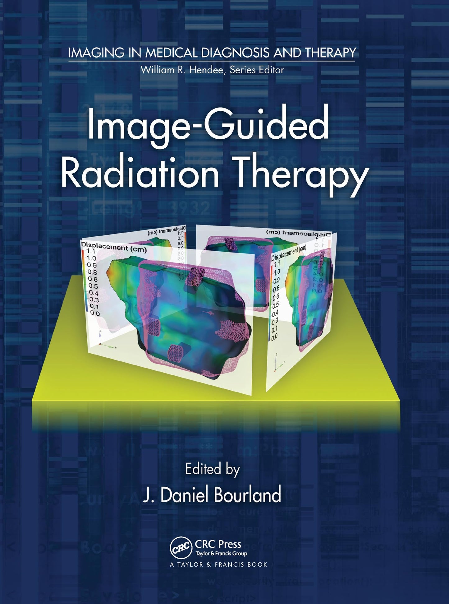 Image-Guided Radiation Therapy (Imaging in Medical Diagnosis and Therapy)