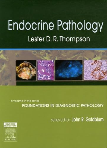 Endocrine Pathology: A Volume in Foundations in Diagnostic Pathology Series - 3809