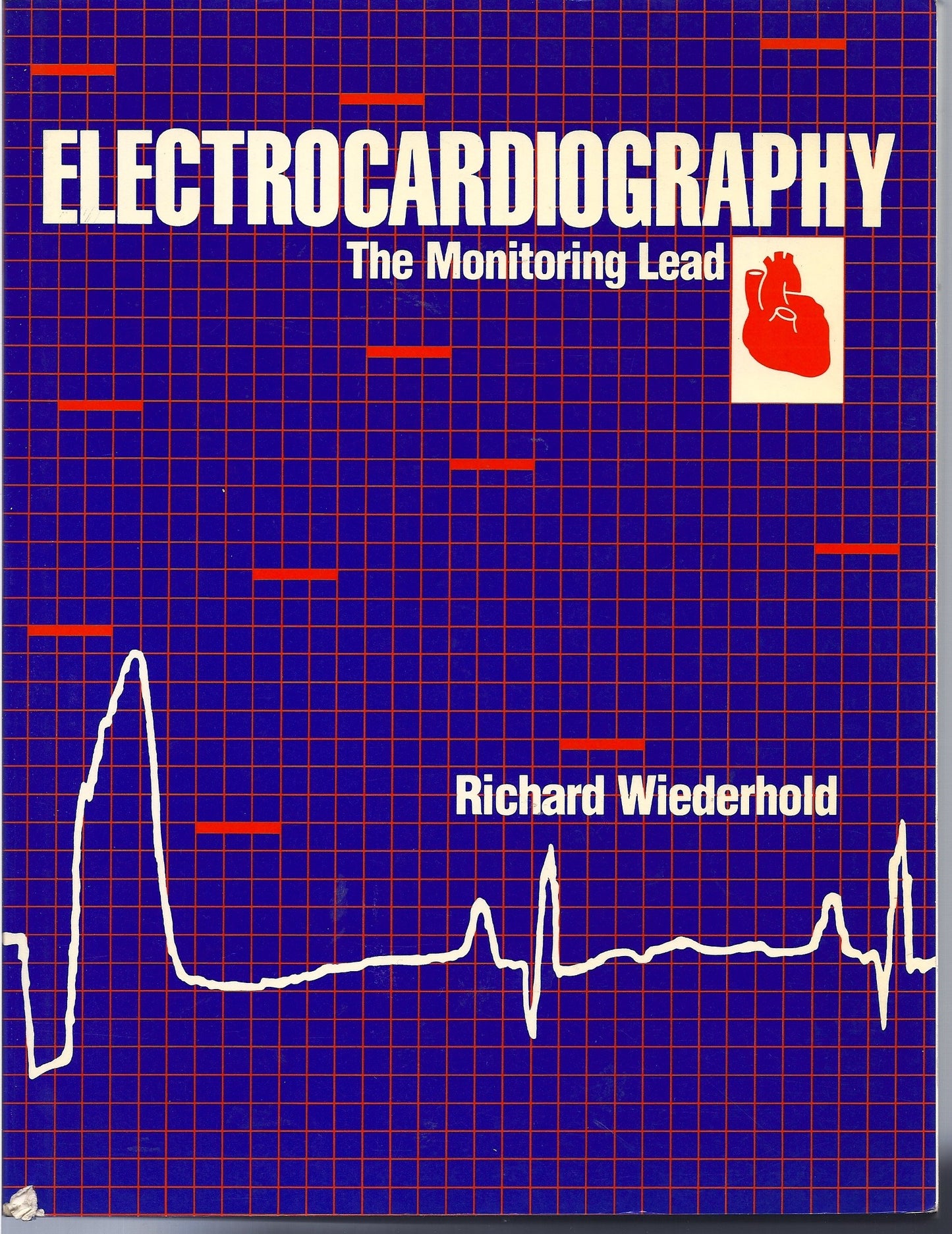 Electrocardiography: The Monitoring Lead