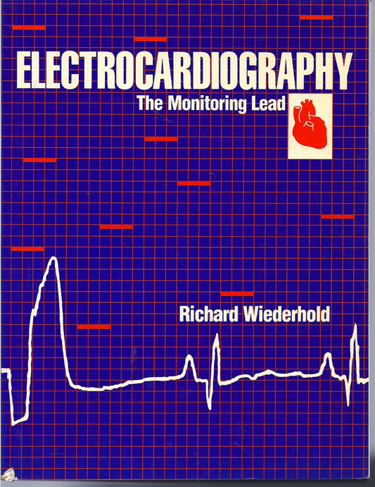 Electrocardiography: The Monitoring Lead