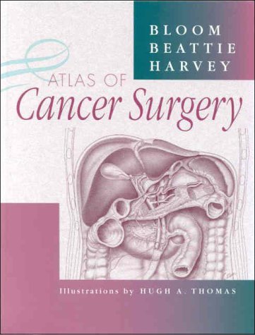 Atlas of Cancer Surgery - 7762