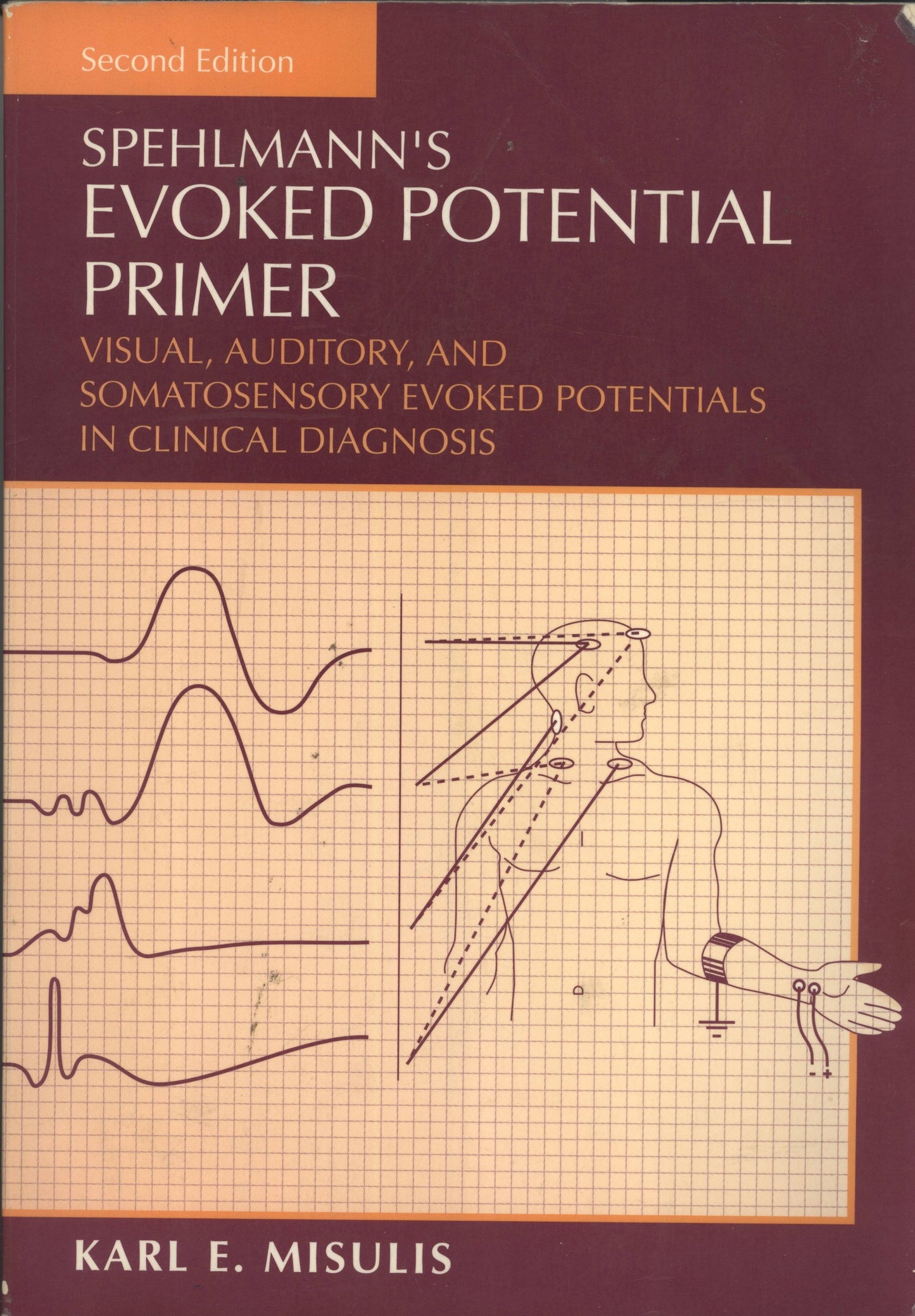 Sphelmann's Evoked Potential Primer: Visual, Auditory, and Somatosensory Evoked Potentials in Clinical Diagnosis