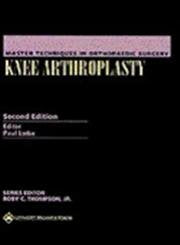 Knee Arthroplasty