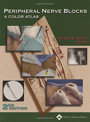 Peripheral Nerve Blocks: A Color Atlas - 9871