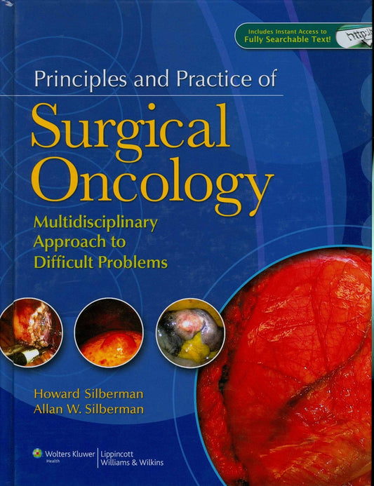 Principles and Practice of Surgical Oncology: Multidisciplinary Approach to Difficult Problems - 8716