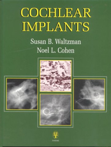 Cochlear Implants - 7516