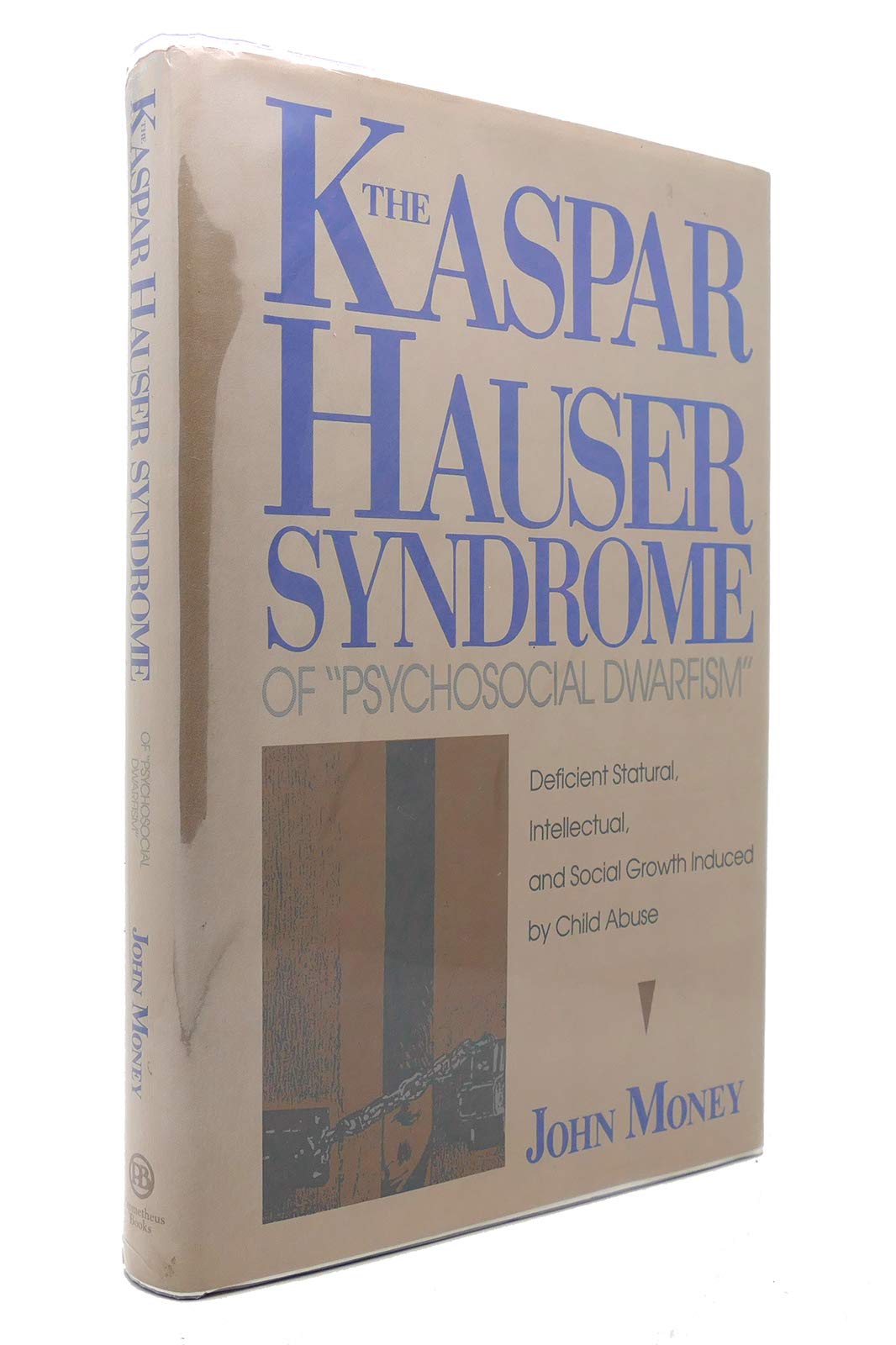 Kaspar Hauser Syndrome of Psychosocial Dwarfism