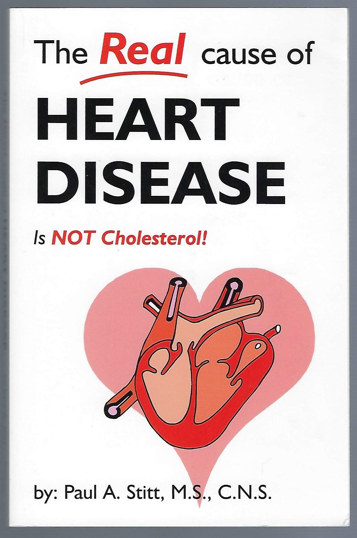 The Real Cause of Heart Disease Is Not Cholesterol