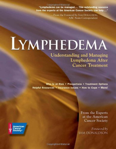 Lymphedema: Understanding and Managing Lymphedema After Cancer Treatment - 6905
