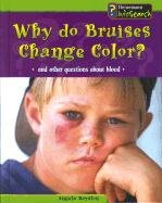 Why Do Bruises Change Color?: And Other Questions About Blood (Body Matters) - 5350