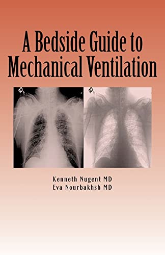 A Bedside Guide to Mechanical Ventilation - 5872