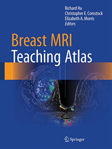 Breast MRI Teaching Atlas - 1688
