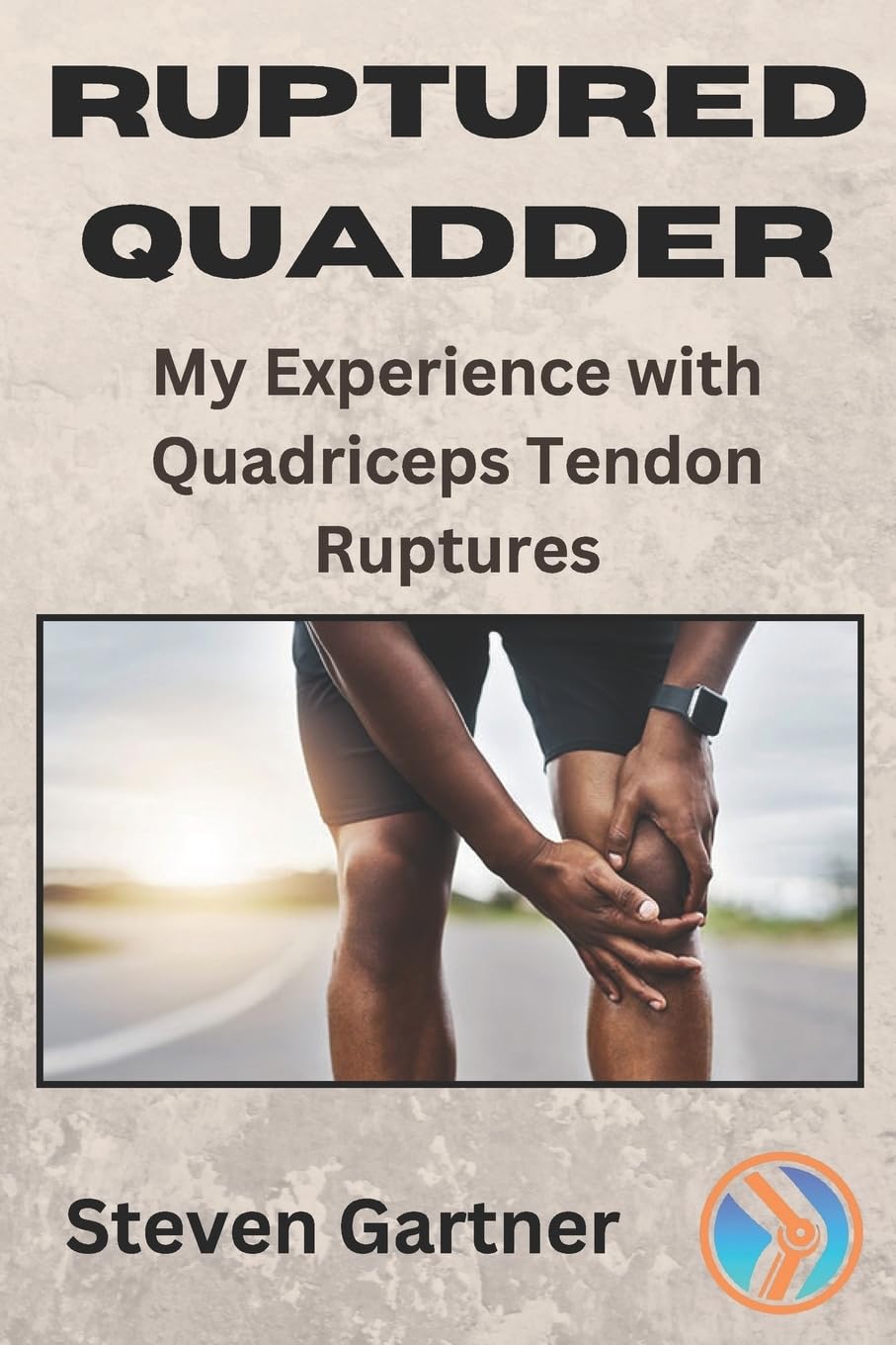 Ruptured Quadder: My Experience with Bilateral Quadriceps Tendon Rupture