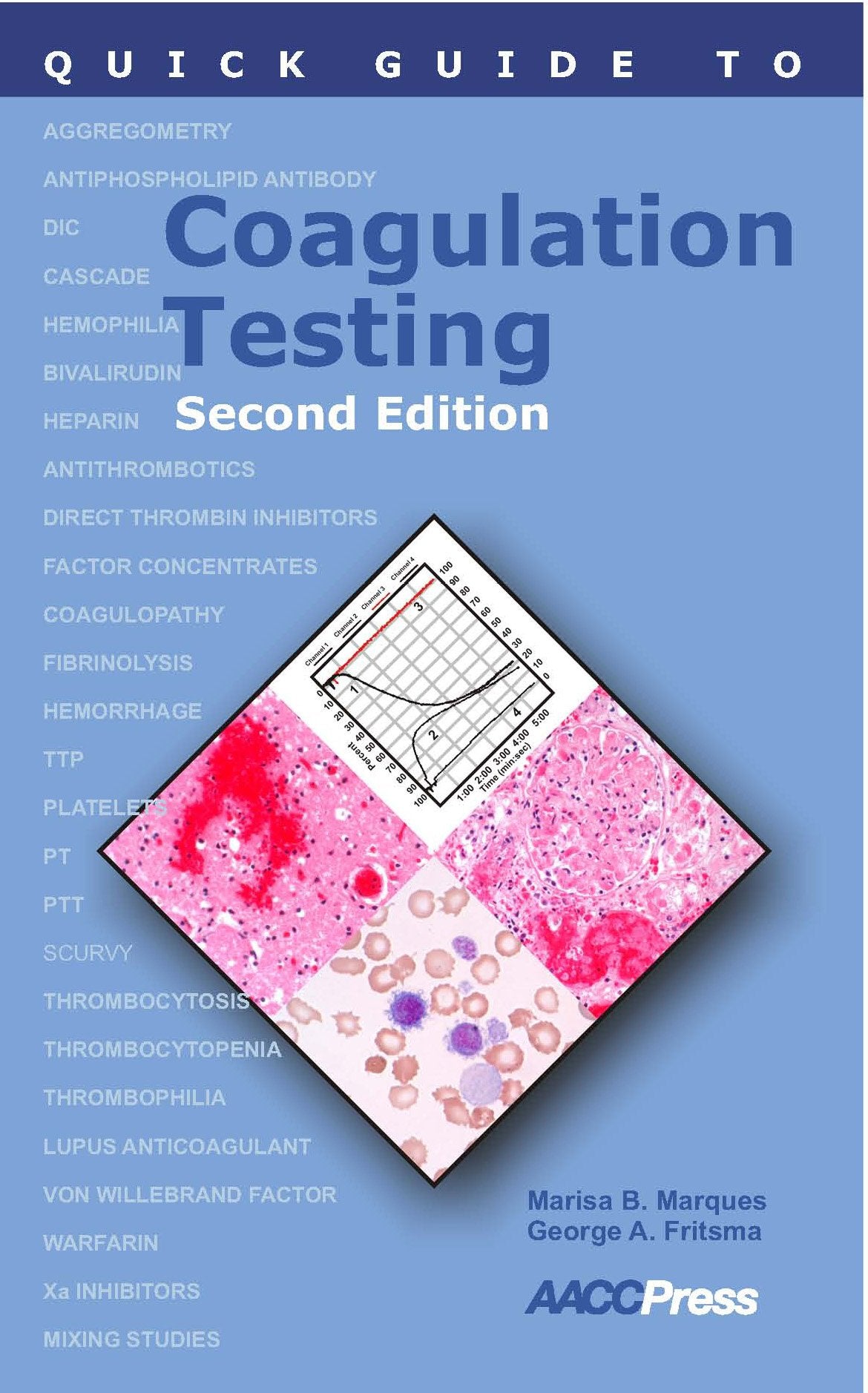 Quick Guide to Coagulation Testing