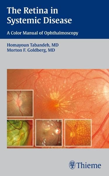 The Retina in Systemic Disease: A Color Manual of Ophthalmoscopy