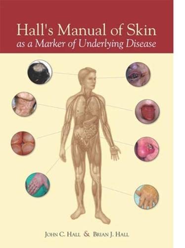 Hall's Manual of Skin As a Marker of Underlying Disease