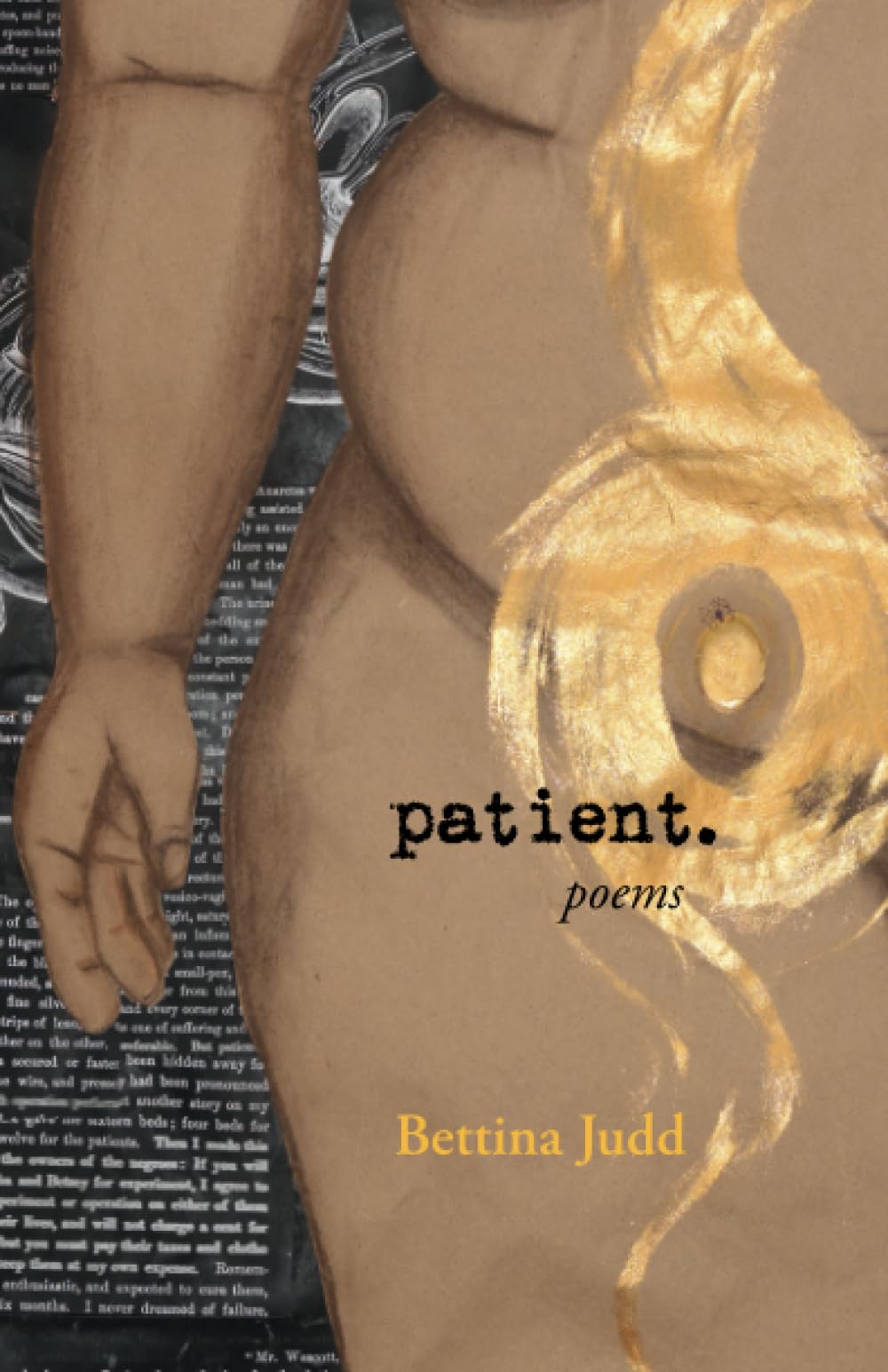 Patient.