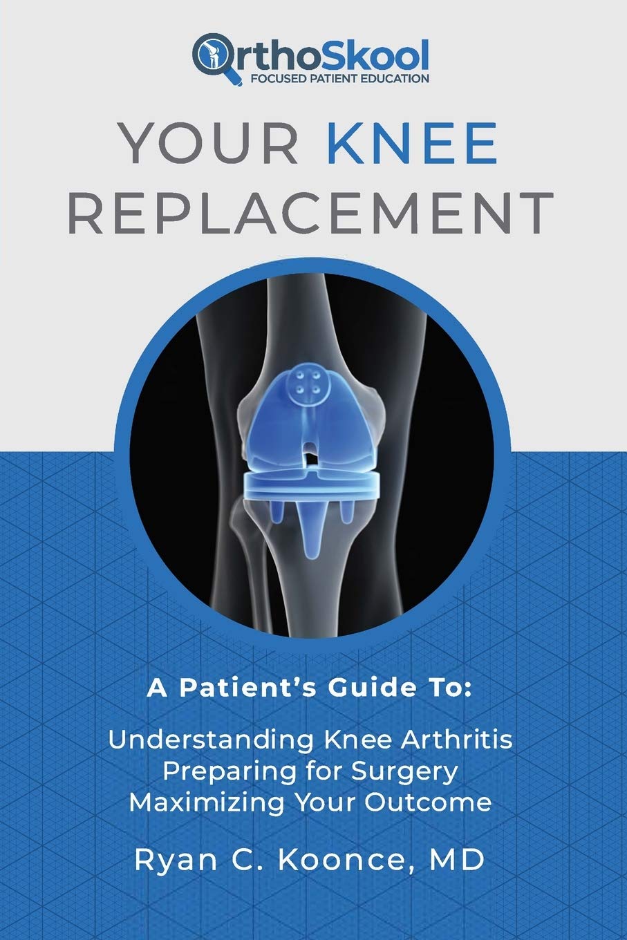 Your Knee Replacement: A Patient's Guide To: Understanding Knee Arthritis, Preparing for Surgery, Maximizing Your Outcome - 5728