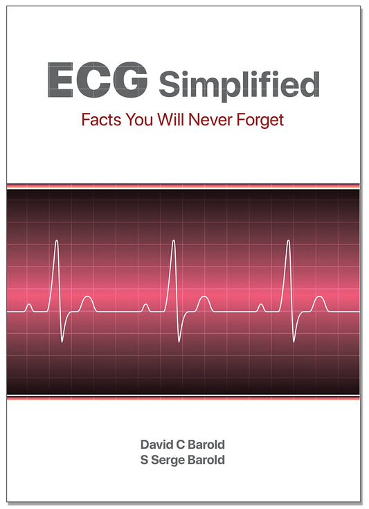 ECG Simplified: Facts You Will Never Forget