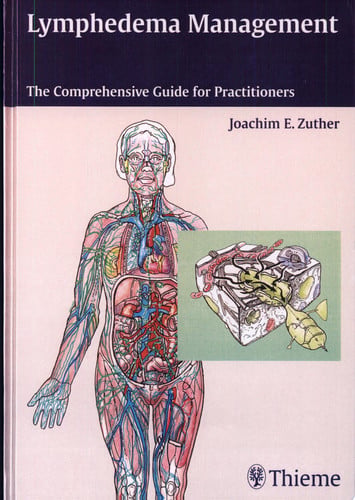 Lymphedema Management The Comprehensive Guide for Practioners