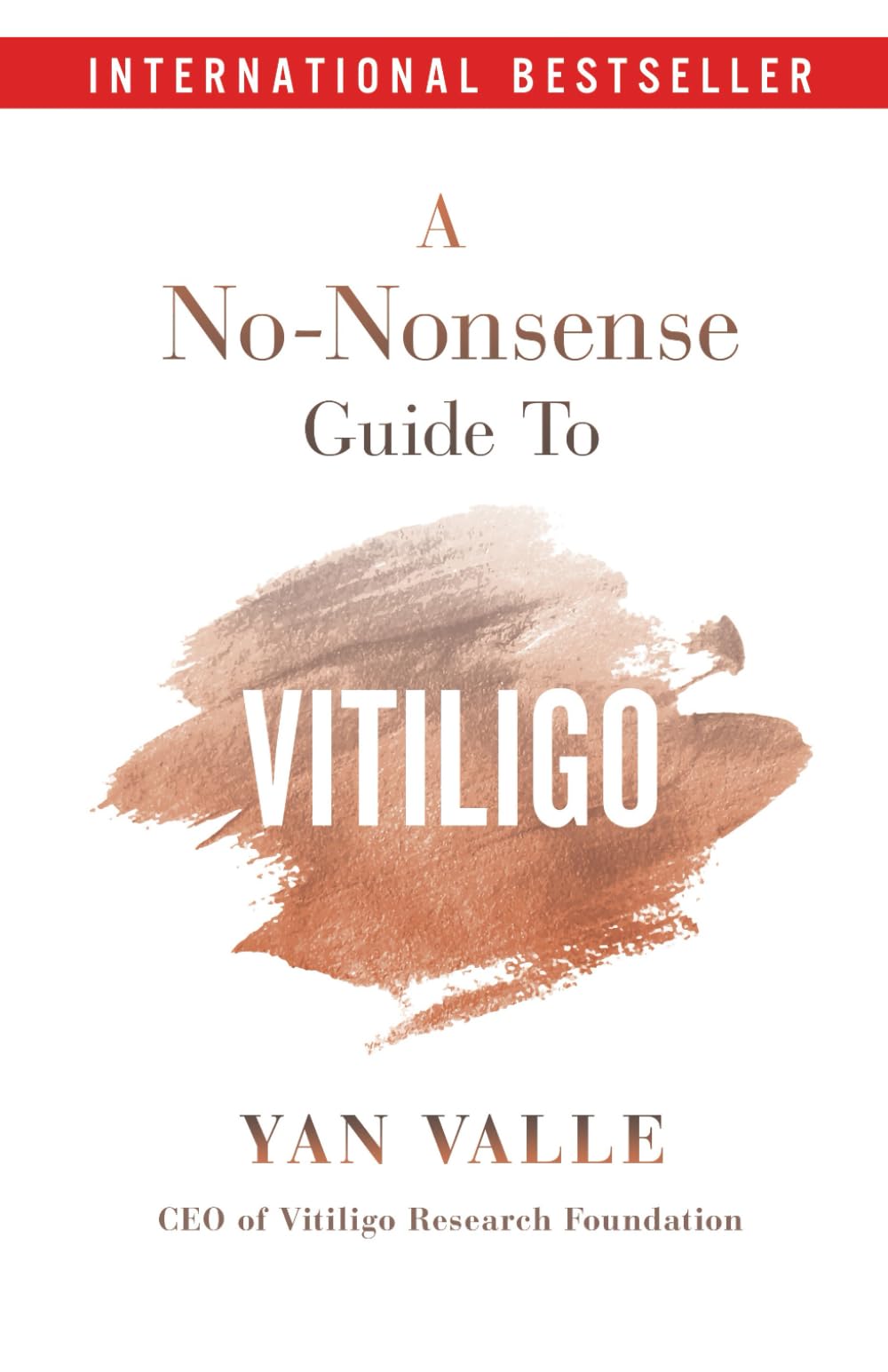 A No-Nonsense Guide To Vitiligo - 7794
