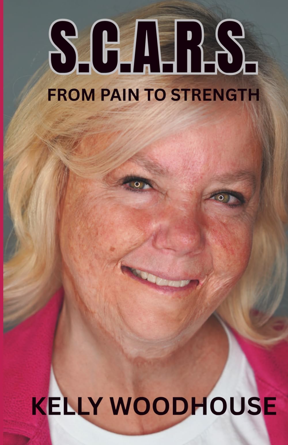 S.C.A.R.S. From Pain to Strength