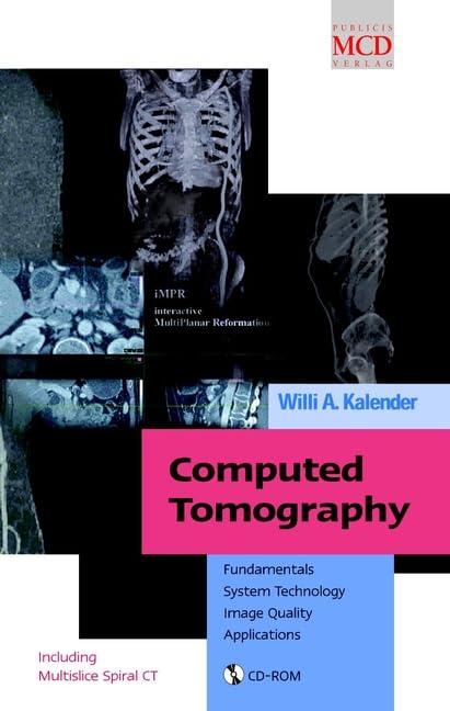 Computed Tomography: Fundamentals, System Technology, Image Quality, Applications