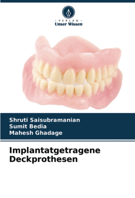Implantatgetragene Deckprothesen (German Edition)