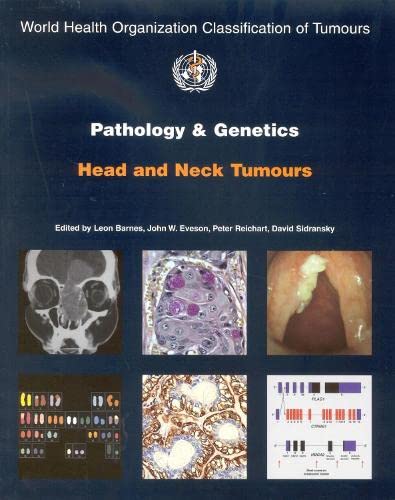 Pathology and Genetics of Head and Neck Tumours [OP] (Medicine)
