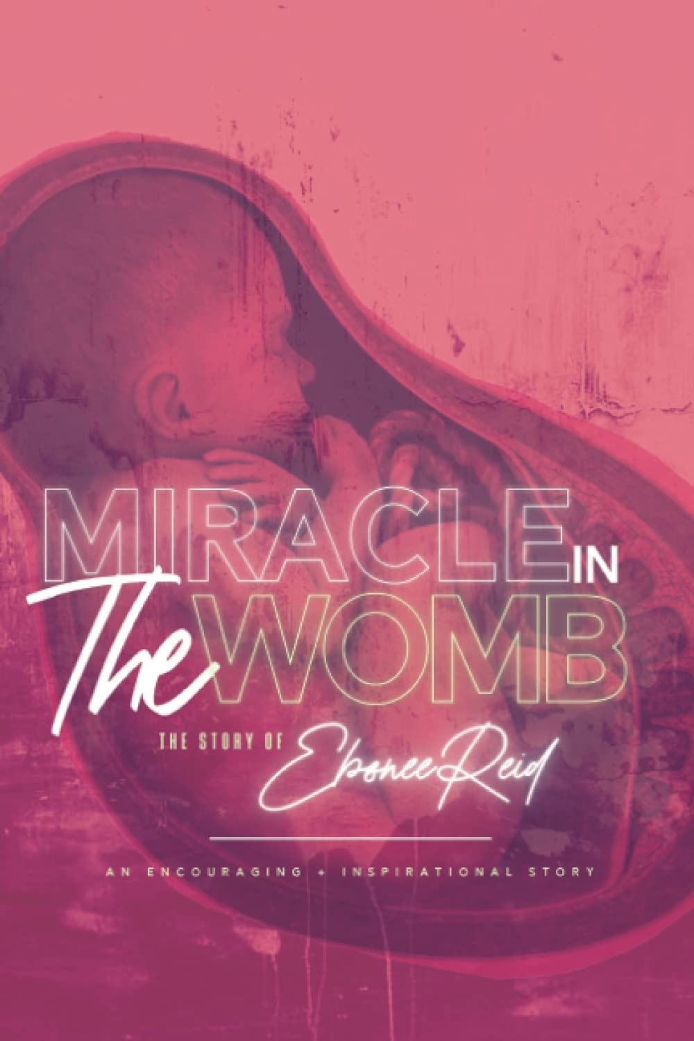 Miracle In the Womb: The Story of Ebonee Reid